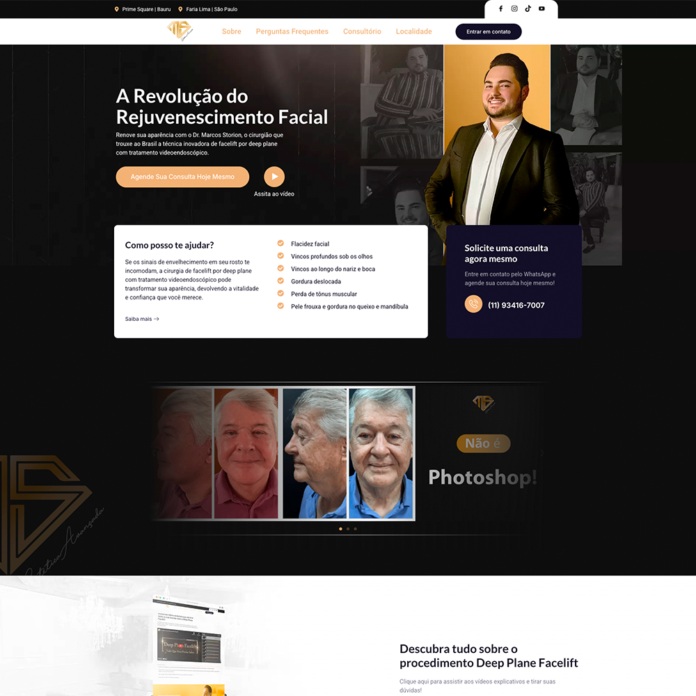 Facelift-Rejuvenescimento-Facial-Dr-Marcos-Storion-01-31-2025_08_37_PM