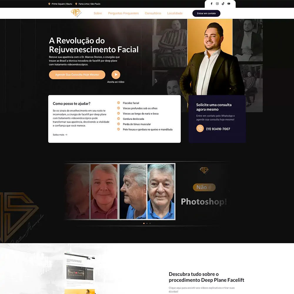 Facelift-Rejuvenescimento-Facial-Dr-Marcos-Storion-01-31-2025_08_37_PM